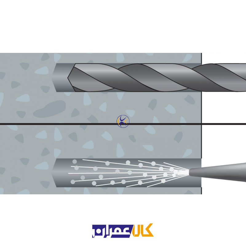 انکر روکش دار 110/Dnbolt 16-80 آپولو میا